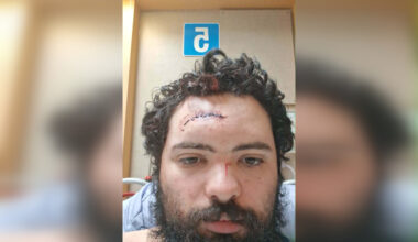 Winnipegger injured, traumatized after being attacked with hatchet in North End