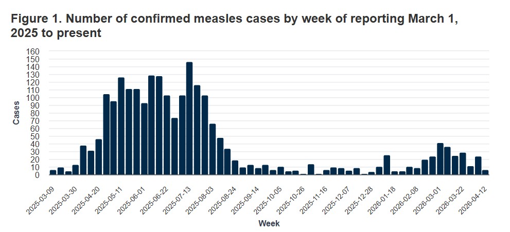 Measles cases in Alberta, AHS Media