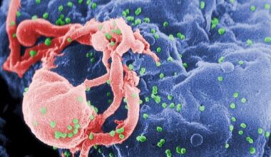 Toronto man’s HIV in remission after bone marrow transplant to treat cancer