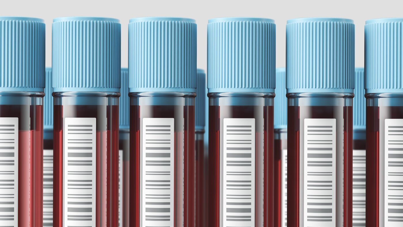 Oura and other wearables offer blood tests. Results may confuse patients : NPR