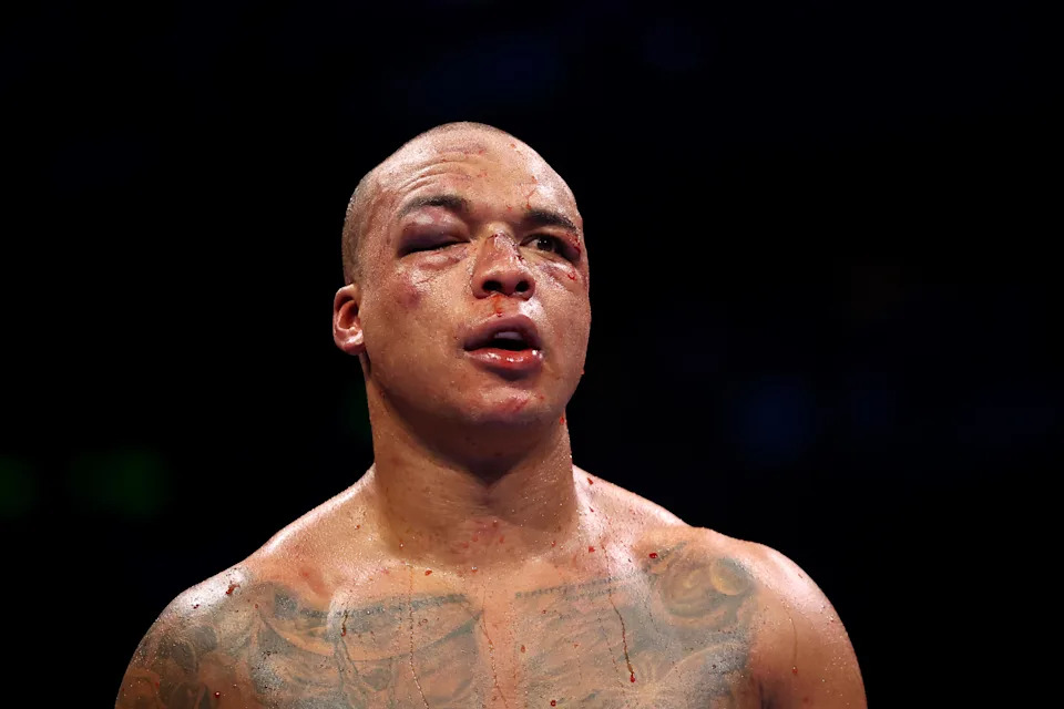 MANCHESTER, ENGLAND - MAY 09: Fabio Wardley looks on during the WBO World Heavyweight Title fight between Fabio Wardley and Daniel Dubois as part of the Wardley v Dubois Don't Blink fight card at Co-op Live on May 09, 2026 in Manchester, England. (Photo by Matt McNulty/Getty Images)