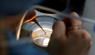 Why are so many babies born by IVF in Jersey?
