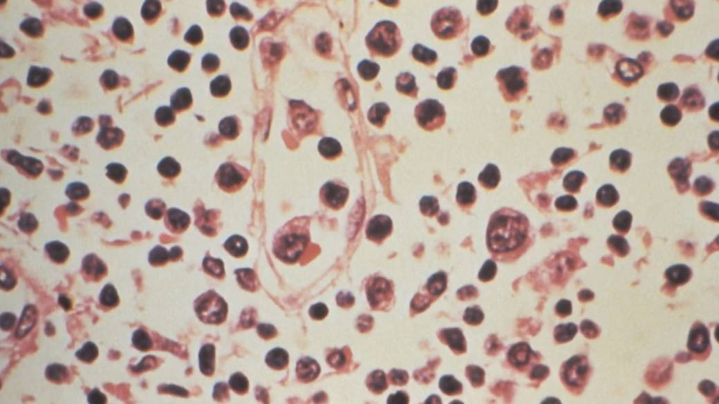 Click to play video: 'Hantavirus: What to know about the Andes strain'