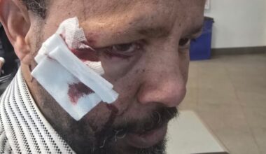 Man called N-word during assault outside St. Albert mosque, friend says