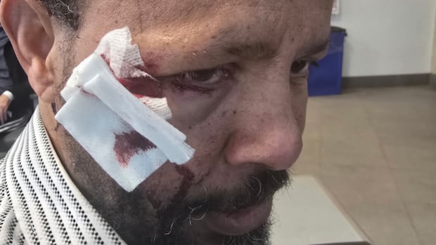 Man called N-word during assault outside St. Albert mosque, friend says