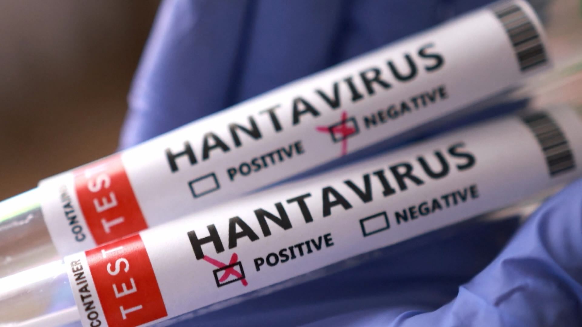 Click to play video: 'Three people isolating in Ontario after Hantavirus exposure'