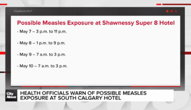 Health officials warn of possible measles exposure in Calgary