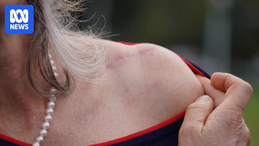 Nicola Spurrier shares road safety message after she was hit by car while cycling