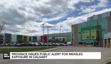 Province issues public alert for measles exposure in Calgary