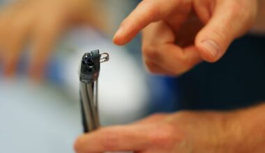 Edmonton hospital using medical technology to offer non-surgical weight loss procedure