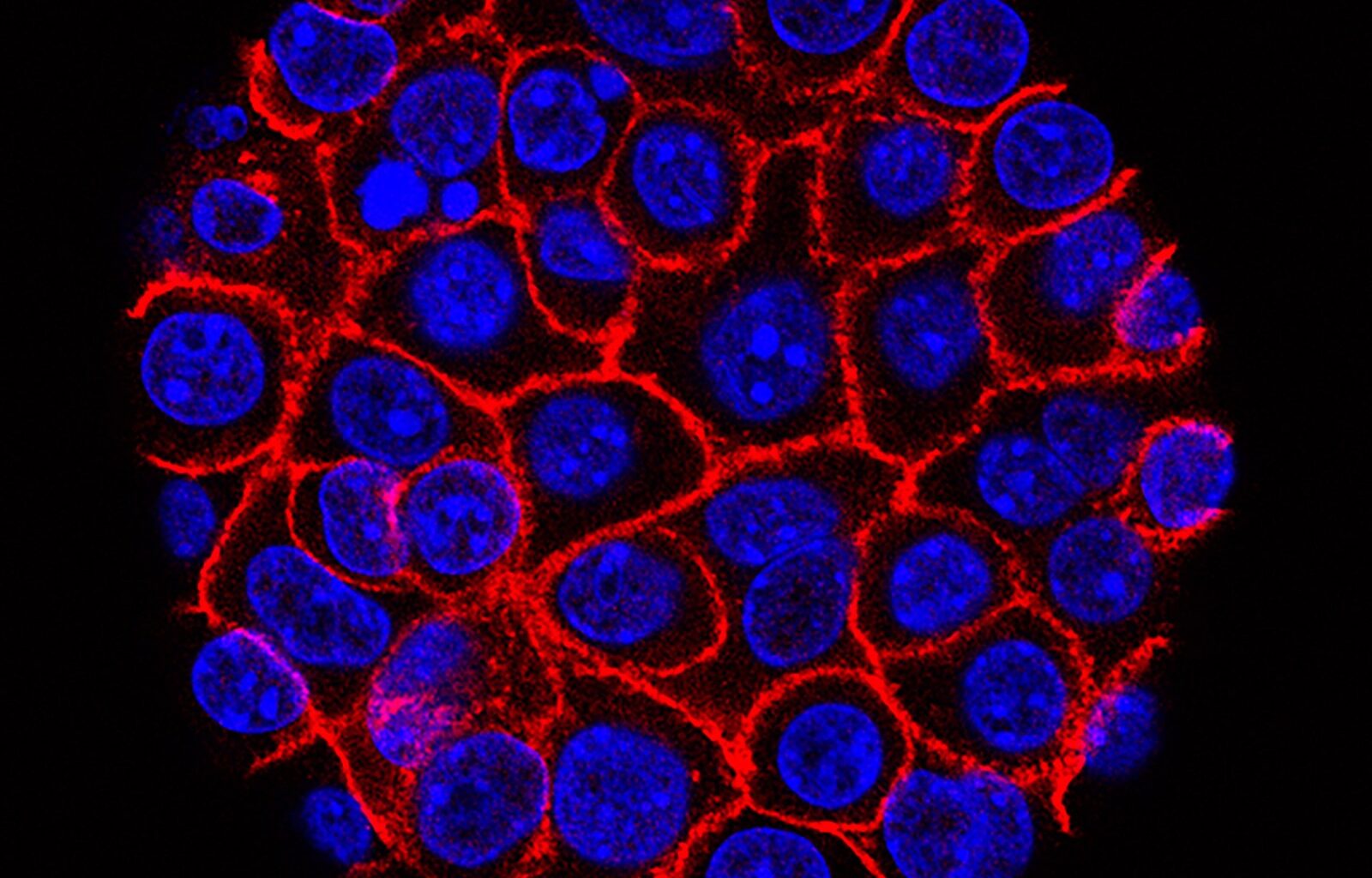 Experimental pill promises new hope for deadly pancreatic cancer – Winnipeg Free Press