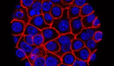 Experimental pill promises new hope for deadly pancreatic cancer – Winnipeg Free Press