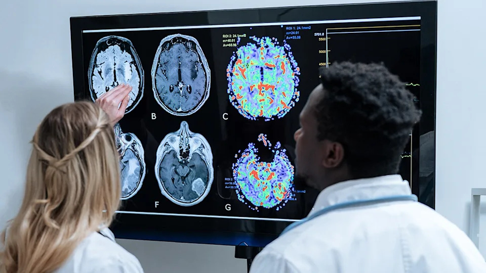 Female and male doctors examining a brain scan on a large screen