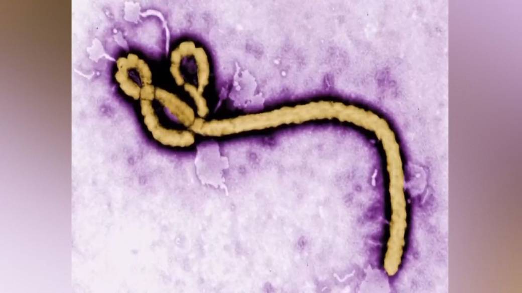 Click to play video: 'DR Congo racing to contain deadly Ebola outbreak'