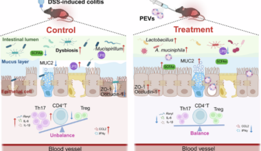 Faecalibacterium prausnitzii-derived extracellular vesicles ameliorate experimental colitis through regulating barrier immunity and gut microbiota