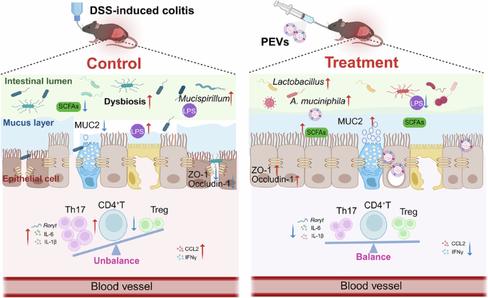 Faecalibacterium prausnitzii-derived extracellular vesicles ameliorate experimental colitis through regulating barrier immunity and gut microbiota