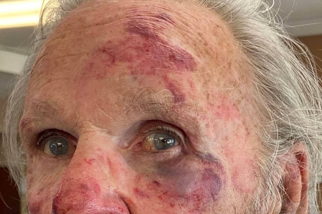 A senior man was assaulted and robbed in Vernon May 5. (Jennifer Smith - Morning Star)
