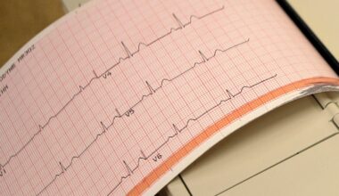 Heart failure rising among young Canadians: research data