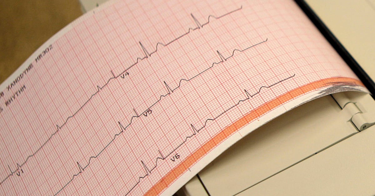 Heart failure rising among young Canadians: research data