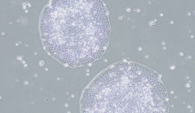 Health panel approves coverage for iPS cell-derived Parkinson’s disease treatment