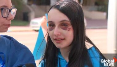 Hundreds rally in Red Deer to support teenage girl recovering from violent assault