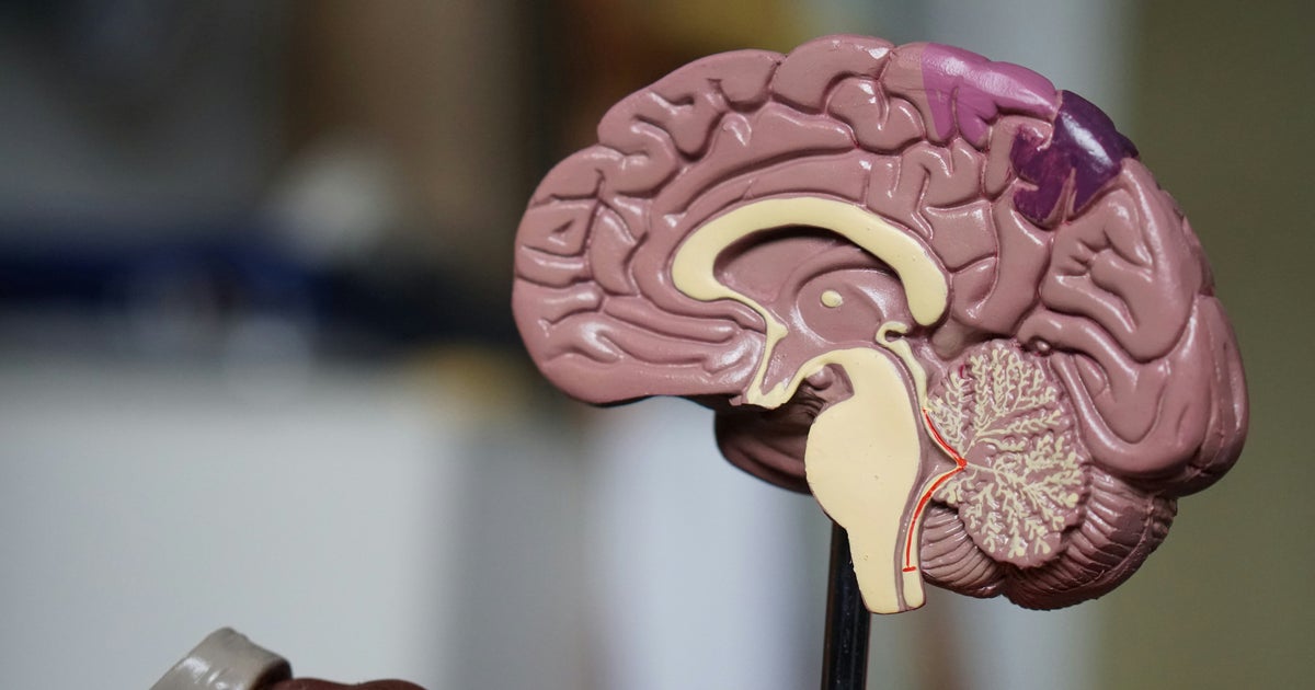 Arginine Could Slow Dementia Damage, Study Finds
