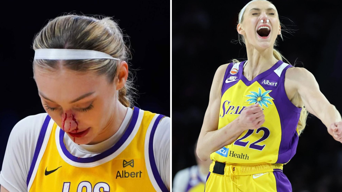 Cameron Brink bleeds for the second time during WNBA game