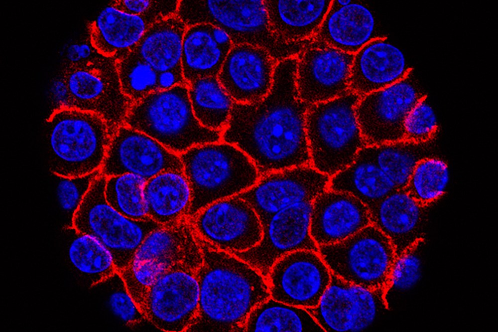 FILE - This undated microscope image from USC via the NIH shows pancreatic cancer cells, nuclei in blue, growing as a sphere encased in membranes, red. (Min Yu/Eli and Edythe Broad Center for Regenerative Medicine and Stem Cell Research at USC, USC Norris Comprehensive Cancer Center, File)