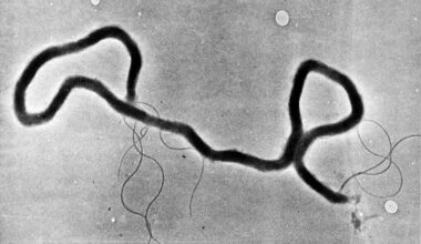 Women now account for most new cases of syphilis in the N.W.T., says territory's top doctor