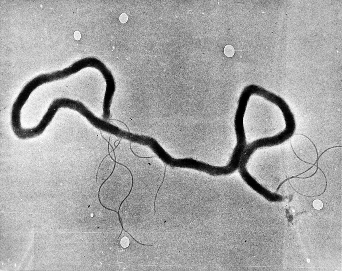 Women now account for most new cases of syphilis in the N.W.T., says territory's top doctor