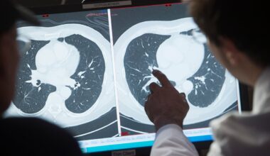 Doctors hail cancer injection that can destroy entire tumors