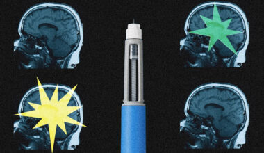 Ozempic may be reshaping the brain, scientists say