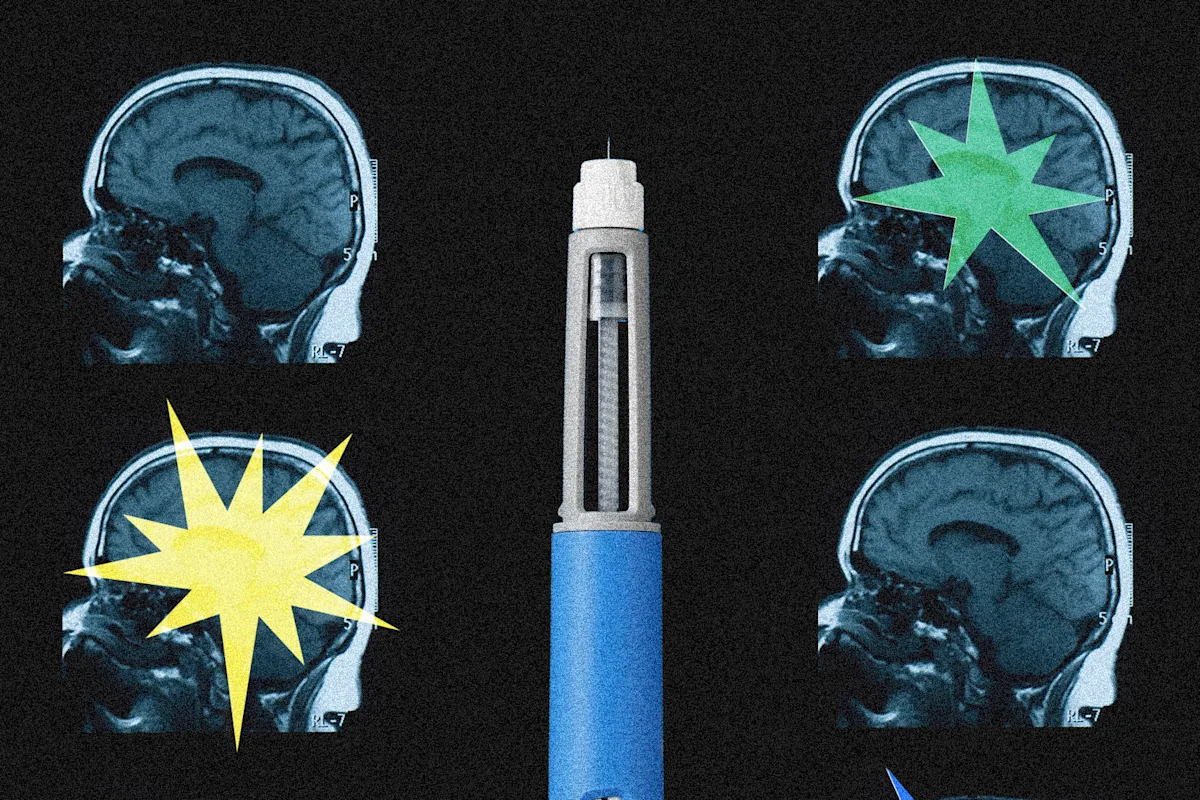 Ozempic may be reshaping the brain, scientists say