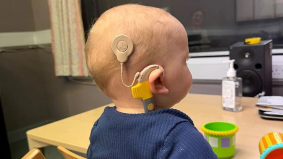 Jasper Carver with his cochlear implant