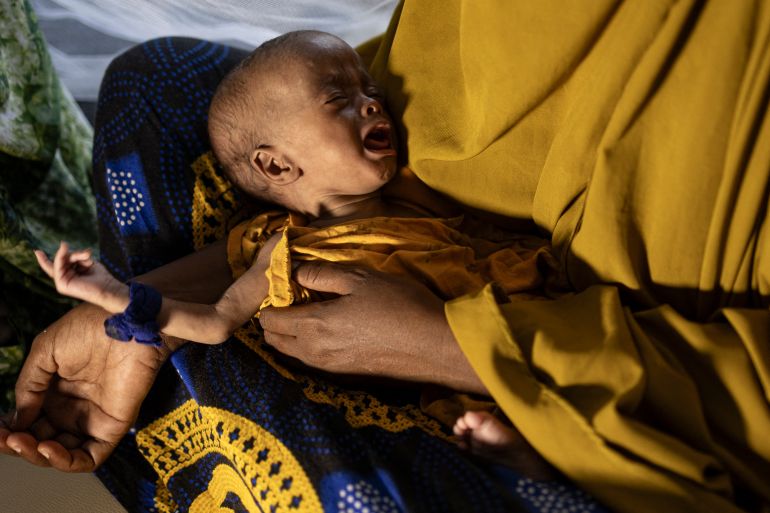 A newly displaced Somali woman holds her severely malnourished baby in a stabilization centre for children suffering severe accute malnutrition in Kismayo,