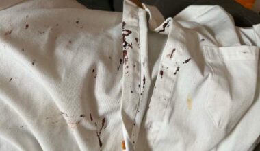 Assault charges laid after chef, bartender injured during Calgary bar fight - Calgary
