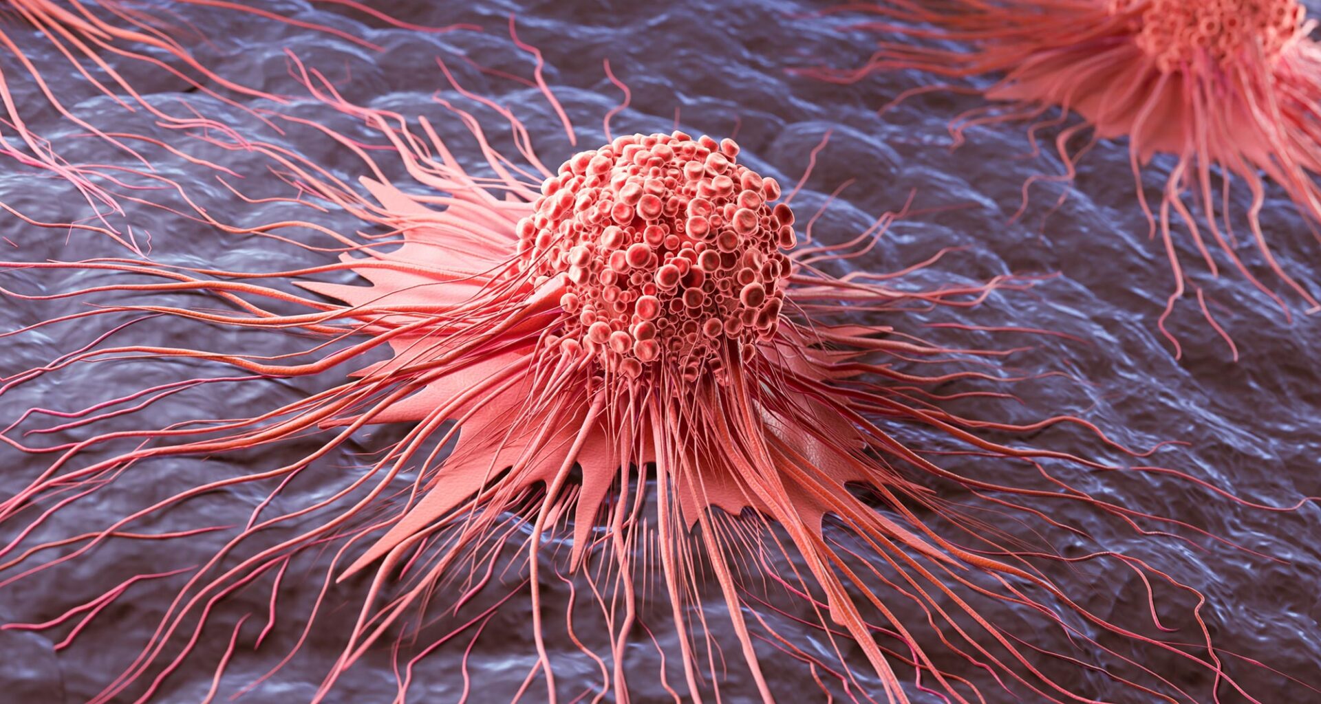 Cancer Cell Spread Abnormal Growth