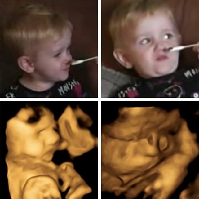 Child reaction