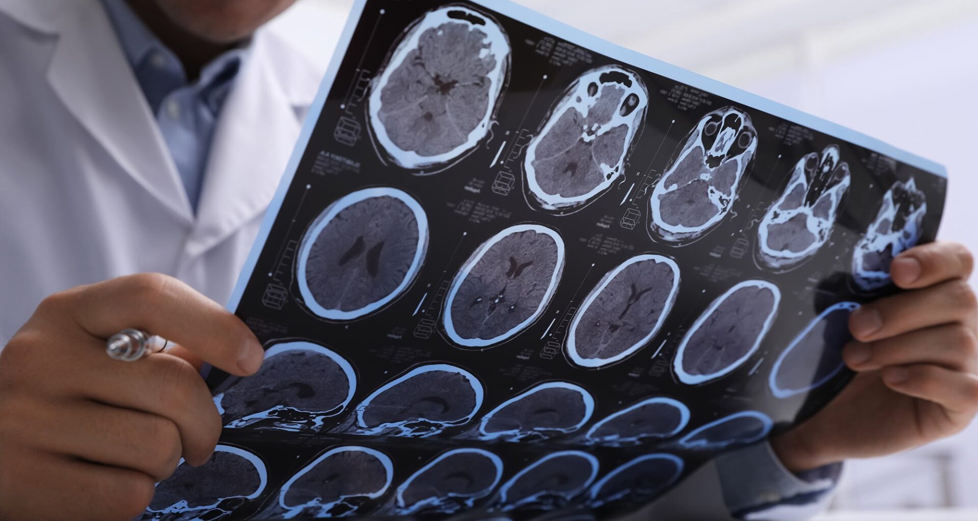 Doctor Examining MRI Scans