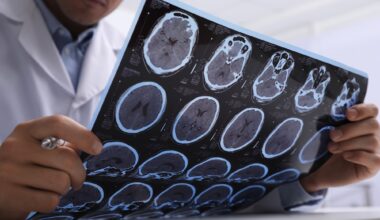 Doctor Examining MRI Scans