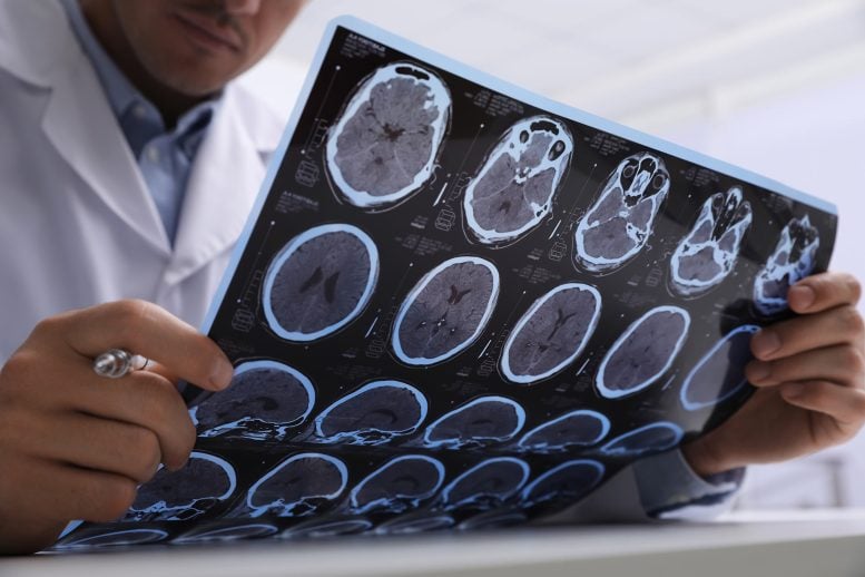 Doctor Examining MRI Scans