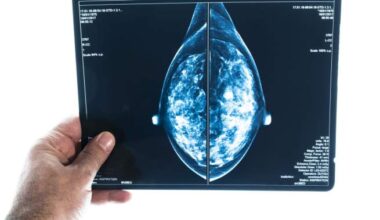 These are the Canadian regions with the highest rates of breast cancer - National