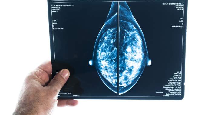 These are the Canadian regions with the highest rates of breast cancer - National
