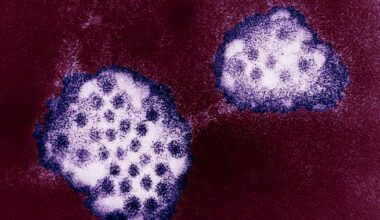 Ontario public health unit warns of infectious stomach illness uptick