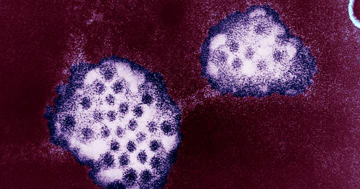 Ontario public health unit warns of infectious stomach illness uptick