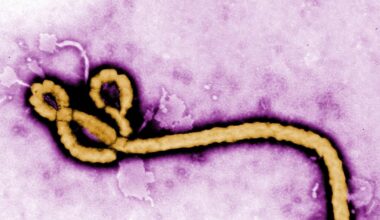 Ebola outbreak: Brazil investigates two possible cases