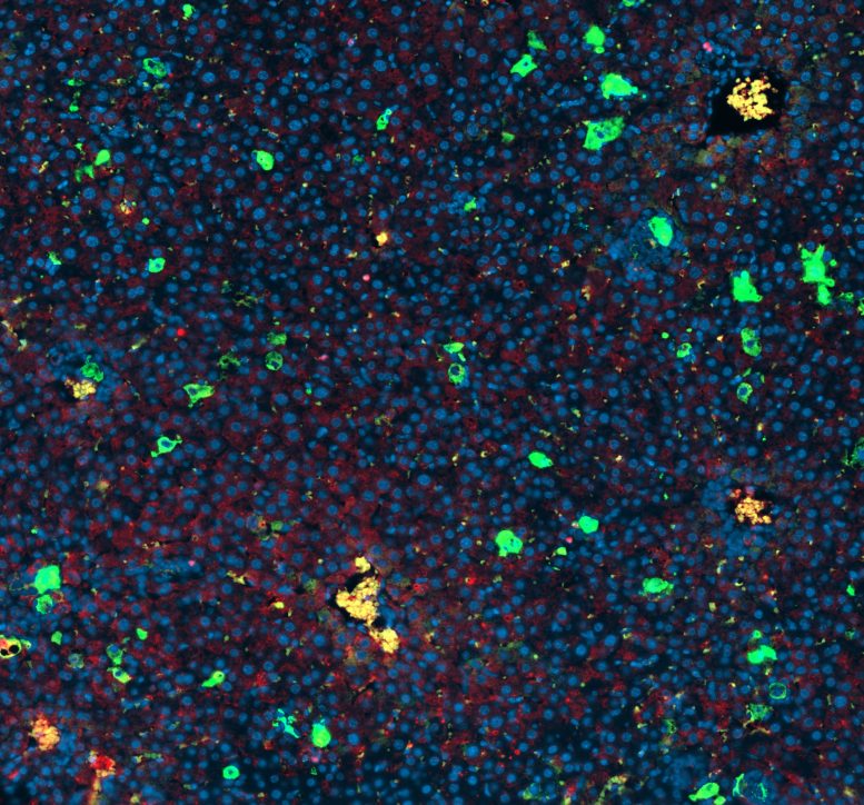 Immunofluorescence Image Showing GPX4, NRAS and NRASGPX4 in Mouse