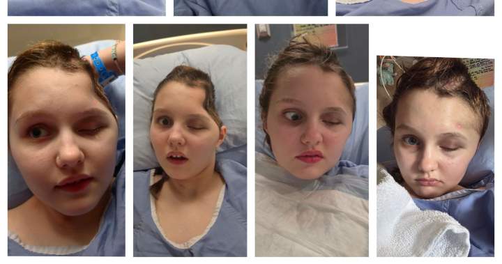 Maya Gebala could have undergone her last surgery, mother says