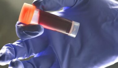 Your Blood Type Affects Risk of Early Stroke, Study Reveals : ScienceAlert
