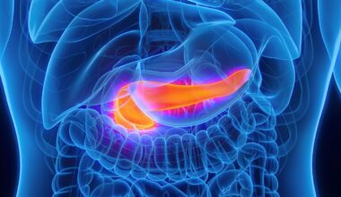 AI Can Spot Pancreatic Cancer Years Before Diagnosis, Study Finds : ScienceAlert